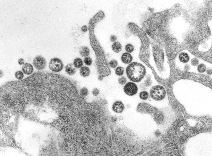 8700_Lassavirus