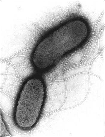 Ecoli_O157_RKI