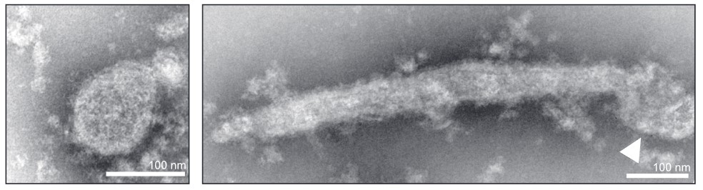 Bourbon-Virus Partikel