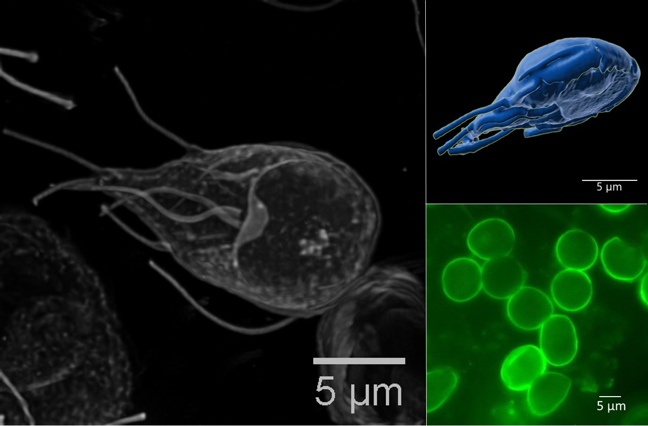 Giardia_RKI