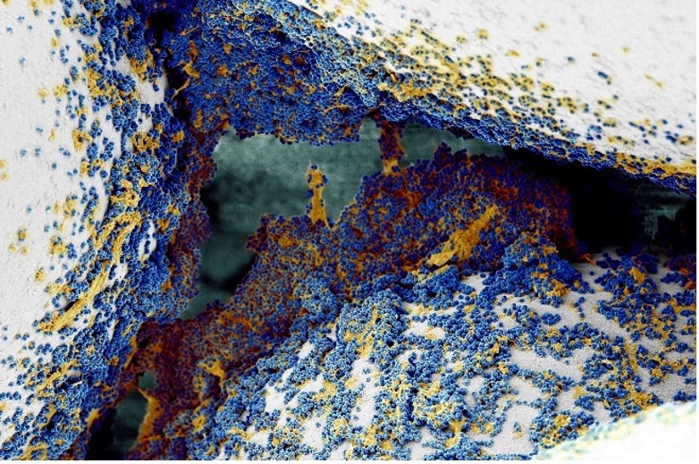 MRSA Biofilm