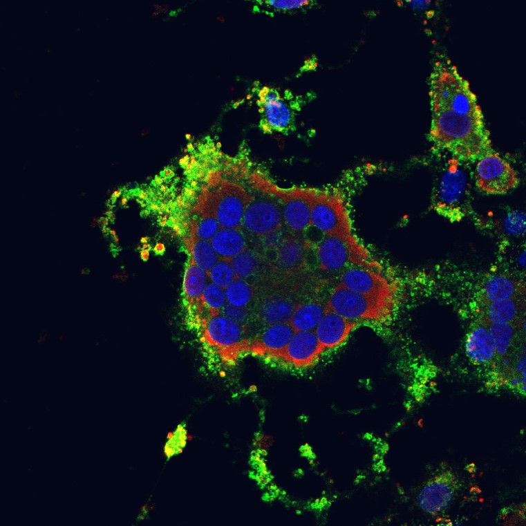 Nipahvirus_fischer_diederich
