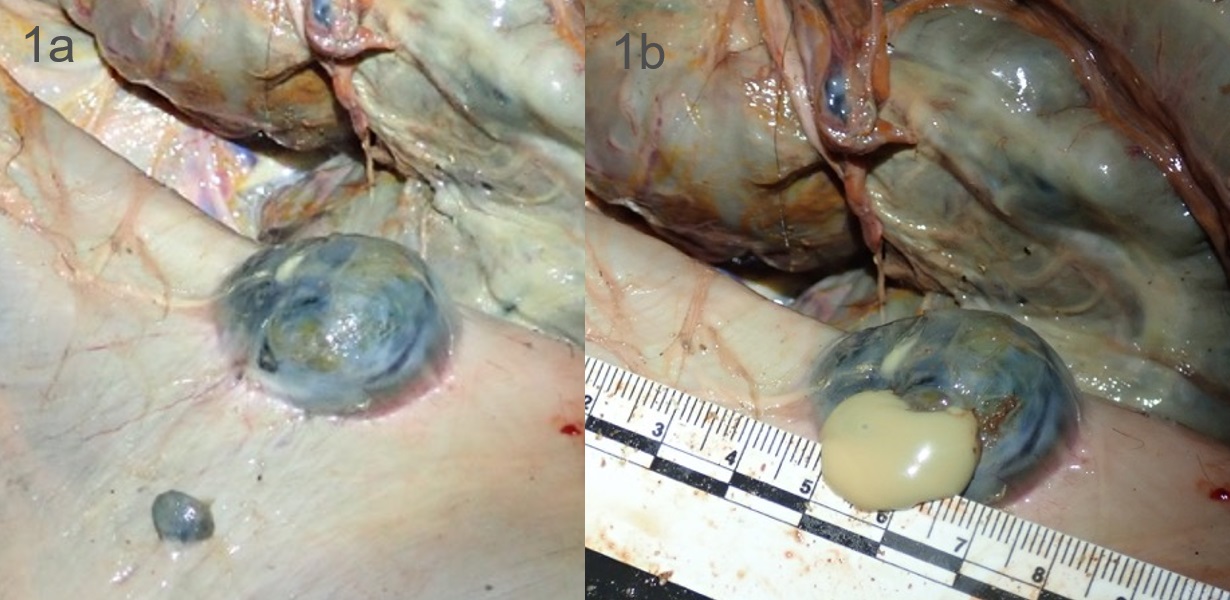 Oesophagostomum_Jaffe