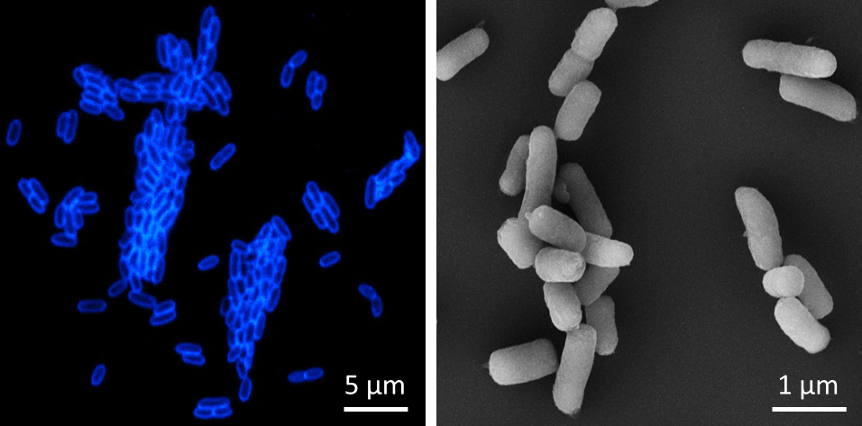 Yersinia pestis_IMB