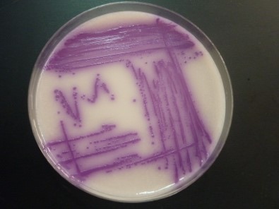 Salmonella_enterica_DDekker